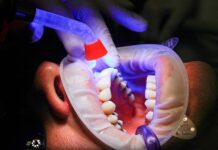zęby, stomatologia